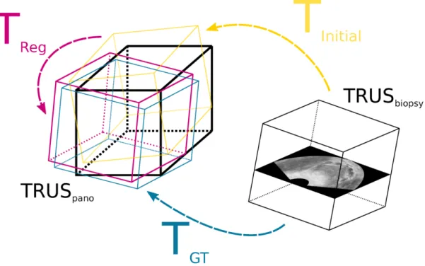 Figure 6. Transformations used by the method. T GT is the ground truth transformation from the biopsy volume and the panorama, T Initial is the initial transformation applied on the biopsy volume and T Reg is the output of the registration algorithm.