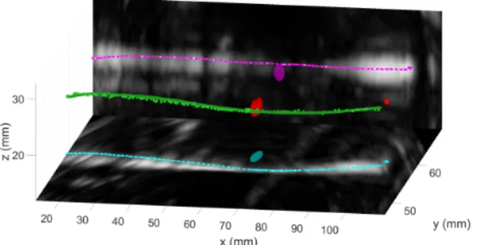 Fig. 8: 3D representation of needle steering in various media. For better visualization, the 2D ultrasound pictures represented here are a combination of 2D slices of a 3D volume, acquired at the end of the needle insertion.
