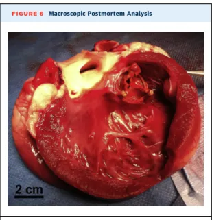 FIGURE 6 Macroscopic Postmortem Analysis