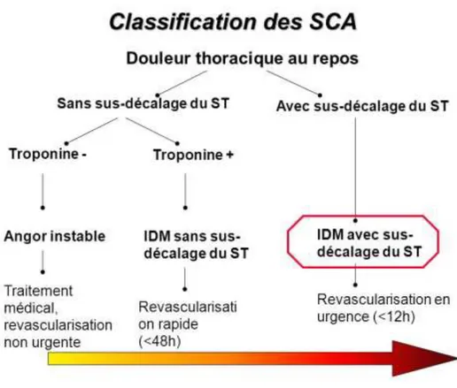 Figure 1: Classification des SCA (6) . 