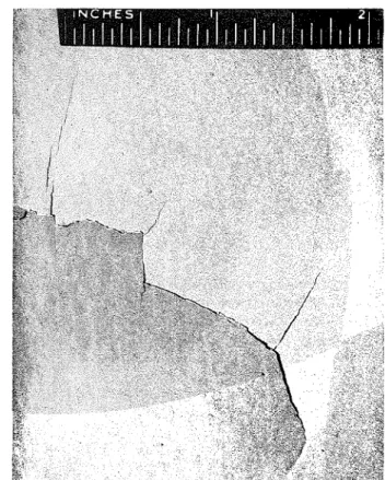Fig. 1 S i n g l e  large bulge of white-coat plaster 