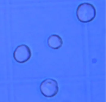 Fig. 2.  Photography  obtained  with  an  optical  microscope  of  lymphoma  cells in their culture medium