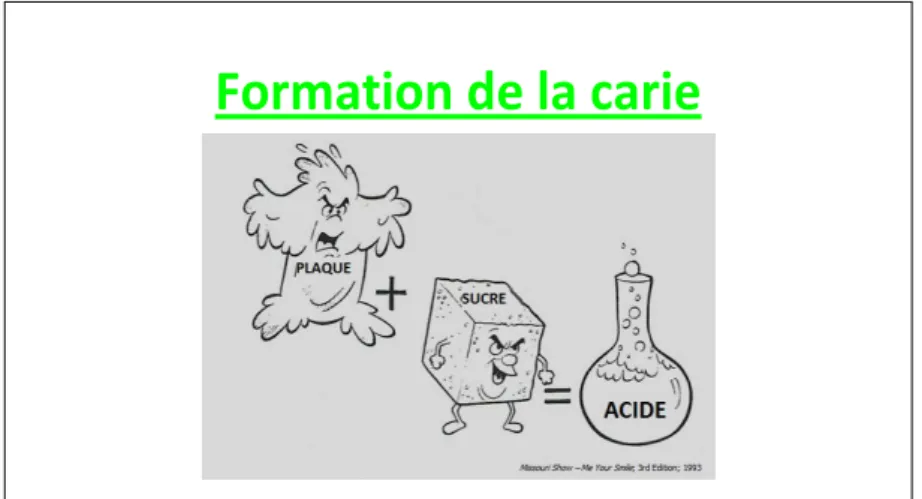 Figure 25 : Diapositive illustrant le rôle du sucre dans la formation de la carie 