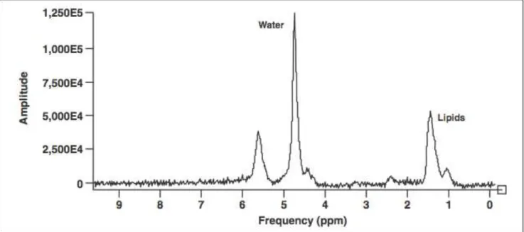 Figure 3 : Exemple de spectre en imagerie ostéoarticulaire :  Principaux pics représentés par l’eau à 4,7 ppm et les lipides à 0,9  et 1,3 ppm                     
