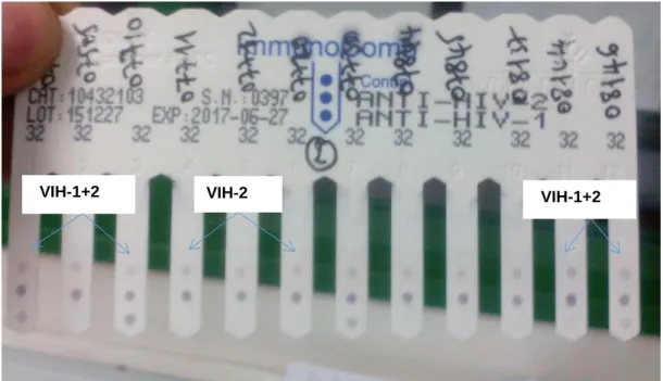 Figure 4: Exemple de résultats Immunocomb HIV-1&amp;2 Bispot avec des réactions croisées au cours des inclusions  dans l'essai FIT-2 à Abidjan en 2016