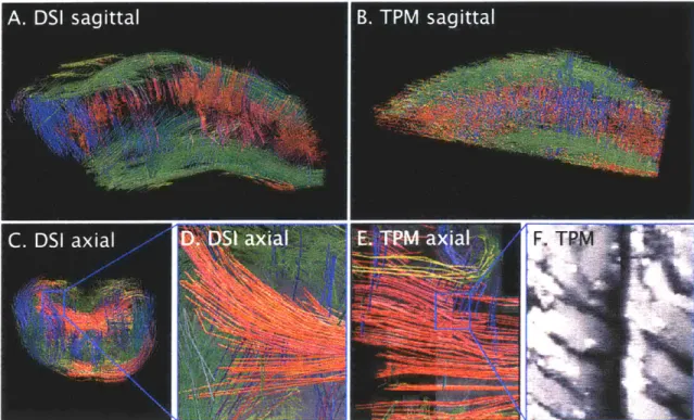 Figure  3.2.2:  Comparison  of mesoscale  tractography  rendering  derived from  diffusion spectrum  imaging  (DSI)  and  two-photon  microscopy  (TPM)