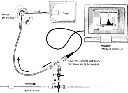 Figure 8: Principe de fonctionnement du circuit artériel de prélèvement intermittent destiné à la  mesure de la concentration en lithium ~ i ' 