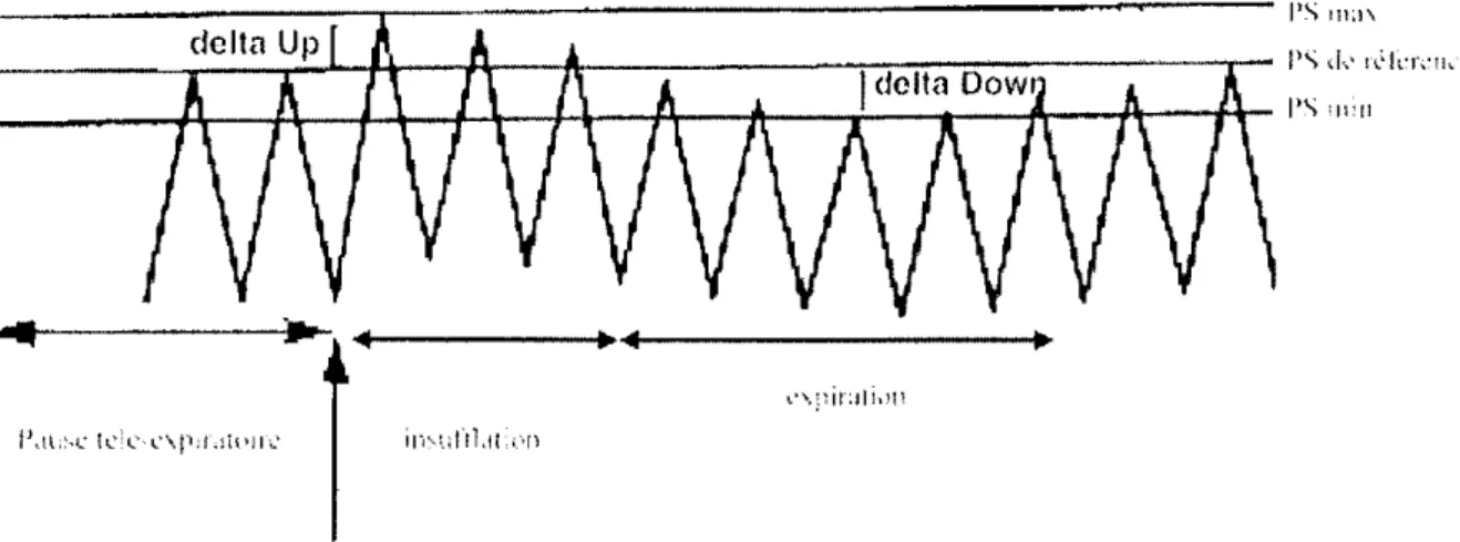 Figure 5 : Mesure des composantes i\down et i\up de la pression artérielle systolique (PS) [56]