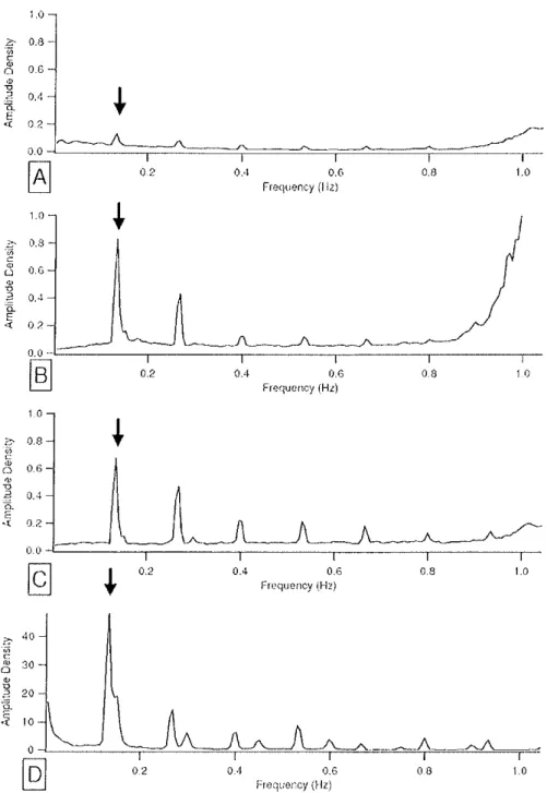 Figure 10: Qualité du signal de l'onde de pléthysmographie en fonction du site de mesure [123].