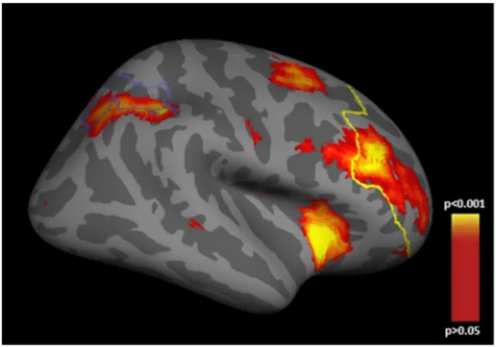 Table 2 Associations between working memory-related load-dependent neural activity and CPLX2 SNPs in schizophrenia patients