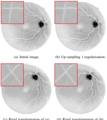 Fig. 10. (a) Grey-level image of dimensions 554 × 554 with 145 grey- grey-levels, and a sample of dimensions 40 × 40 (courtesy of the DRIVE dataset [54])