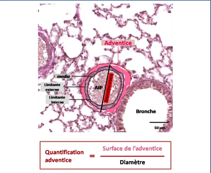 Figure 18 : Méthodologie de la quantification de la surface de l’adventice 