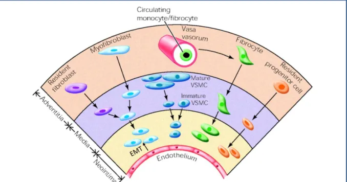 Figure 9 : Représentation schématique des différentes hypothèses quant à l’origine des  cellules responsables de l’épaississement de la media et de l’intima 