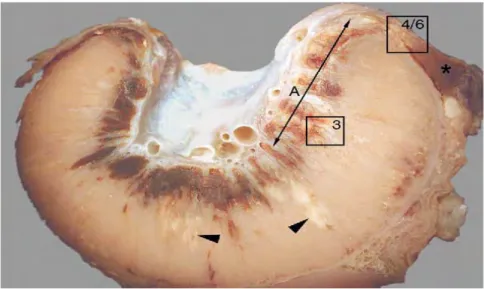 Figure 8 : Placentome d’une brebis 28 jours après une infection expérimentale à C. abortus,  fixé au formol, surface d’une coupe transversale (Sammin et al., 2006) 