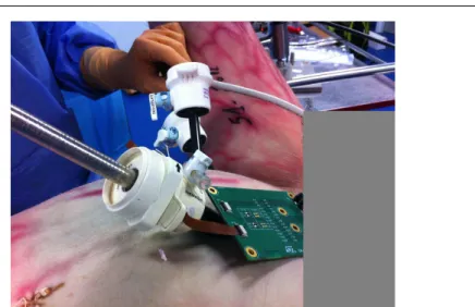 Fig. 10 Photography of the preclinical validation of our system on a human cadaver.