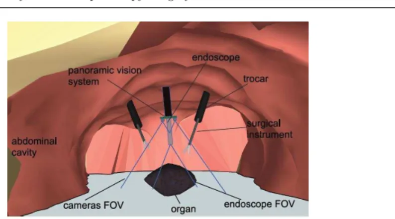 Fig. 1 Schematization of the proposed concept of global vision system.
