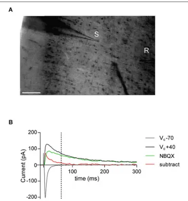 FIGURE 1 | AMPA—NMDA ratio experimental design. (A) Bright-field snapshot of coronal slice detailing prelimbic mPFC division (x-axis medial—lateral; y-axis dorsal—ventral)
