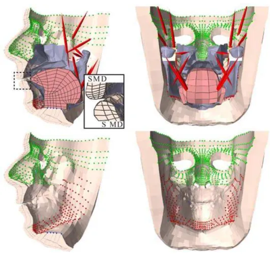 Figure 3. Upper panel: Sagittal cut-away (left) and posterior (right) views of the dynamic 