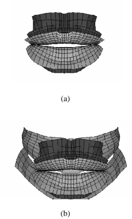 Figure 4- Surface contact elements between lips (a) and lips and teeth (b). 