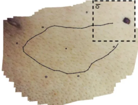 TABLE III: Method comparison on data-II (pig bladder).