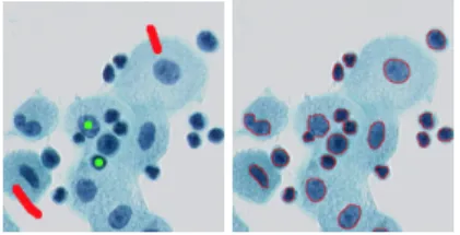 Figure 2 – Semi-supervised classification. Left : graph with initial labels. Right : segmented image.