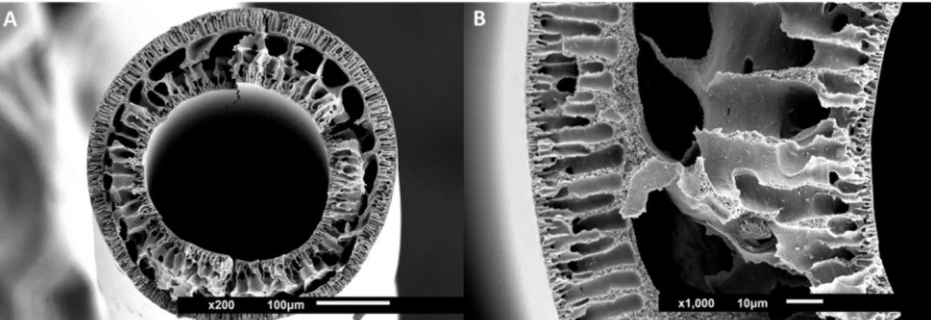 Fig. 8. SEM images of hollow fiber PES-SS2 membranes. Images show cross-sections with magnifications of 200×, size bar 100 μm (A) and 1000×, size bar 10 μm (B), zoom-in.