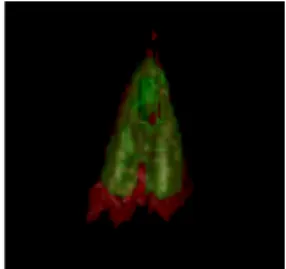 Fig. 1. MR images obtained at the beginning of the exam. 
