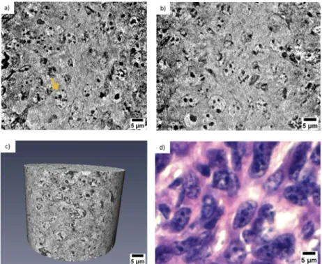 Fig. 5. (a) Minimum intensity projection image of 14 reconstructed nanotomography slices.