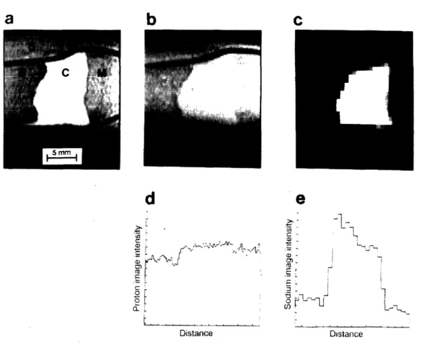 FIGURE  11  a)  Proton  image  (echo  time  =  15  msec)  of a  distal  ulnar  joint  immersed  in saline  (S)