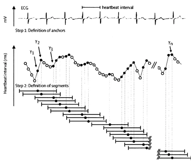 Figure I-5. Anchor and Segment Selection  for  Deceleration Capacity.  Anchors  are defined by a heartbeat  interval  that is longer than the preceding  interval