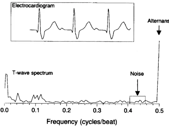 Figure 1-6.  T-wave Power Spectum  for  Electrical Alternans. The power  spectrum of the  T-wave  is shown  above