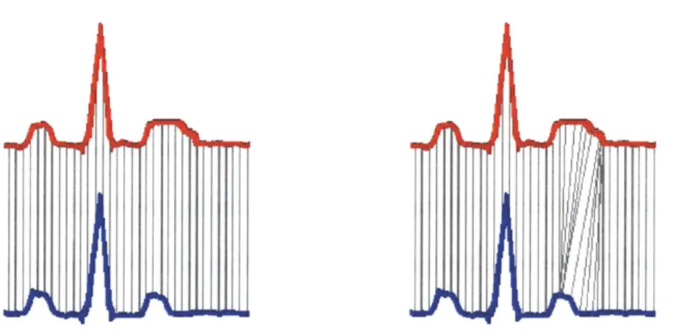 Figure H-1.  Dynamic  Time  Warping Beat Alignment.  In the  figure  on the left, samples  in  the red beat are  directly compared  to samples  that  occur at the  same time in the  blue beat