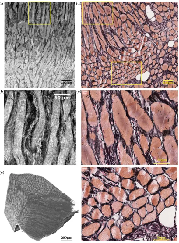 Figure 3.  Comparison between (left) synchrotron high-resolution X-ray microtomographic images (PRI  mode, V vox =  0.65 3 μ m 3 ) of the left vocalis fibrous network and (right) 2D histological photomicrographs of the  right vocalis excised from the same 
