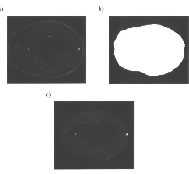 Figure  3  Removing  the  skull  in  the  MRA  image  by  the  brain  mask  generated  from  Ti- Ti-weighted  MRI  image