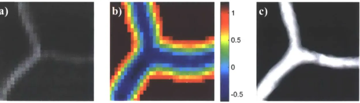 Figure  5  Segmentation  process  flow,  taking  a  segment  of  vascular  bifurcation  for illustration