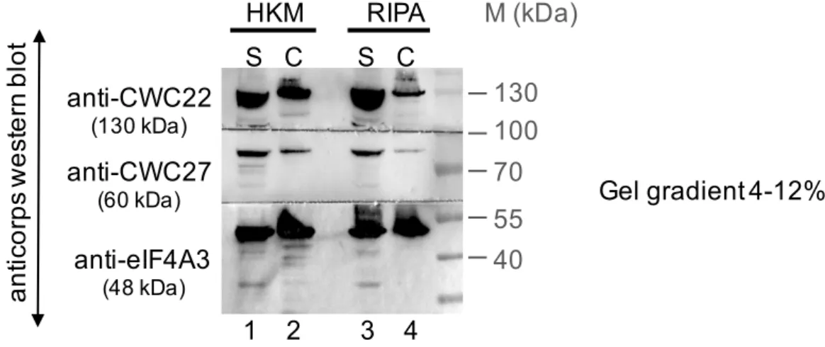 Figure 11: Analyse par western blot des lysats cellulaires obtenus à l’aide des tampons  HKM et RIPA