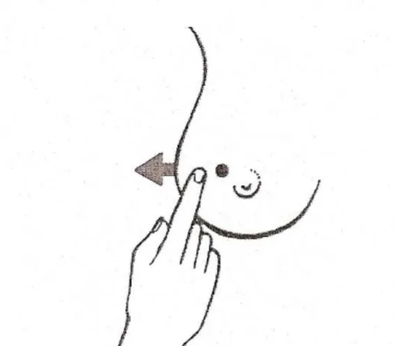 Figure 3 : recherche d'une connexion cutanée  par déplacement avec le doigt de la peau en  regard de la tumeur [13] 