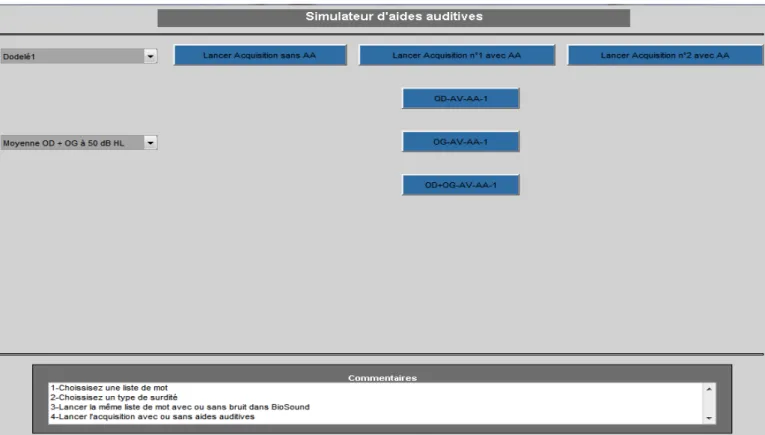 Figure   30   :   Interface   de   simulation   programmée   pour   une   perte   bilatérale   de   50   dB   avec   utilisation   de   la   liste   1    de   Dodelé   