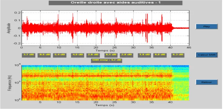 Figure   31   :   SNR   obtenu   pour   l'oreille   droite   avec   les   appareils   Go   Pro   (SNR   en   entrée   :   +6   dB)   