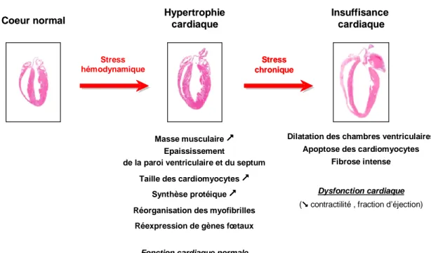 Figure  12  Remodelage  ventriculaire  survenant  au  cours  de  l’hypertrophie  et  de  l’insuffisance cardiaques (D’après Hill, 2003)