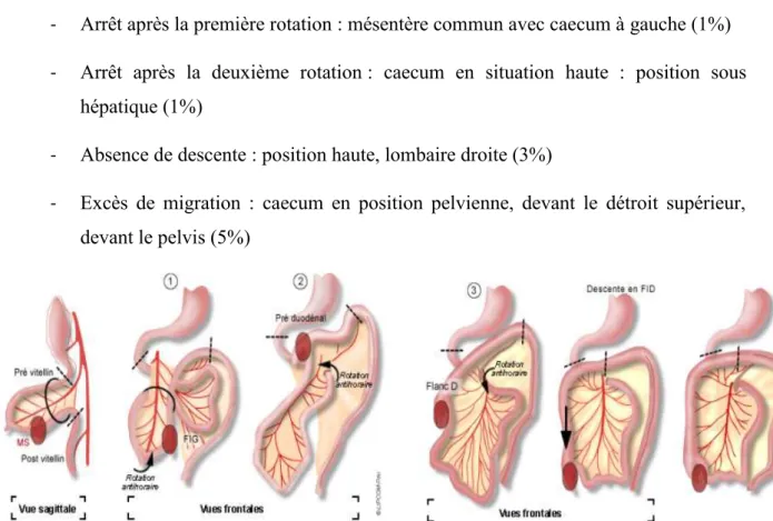 Figure 3 : développement embryonnaire de l'appendice 