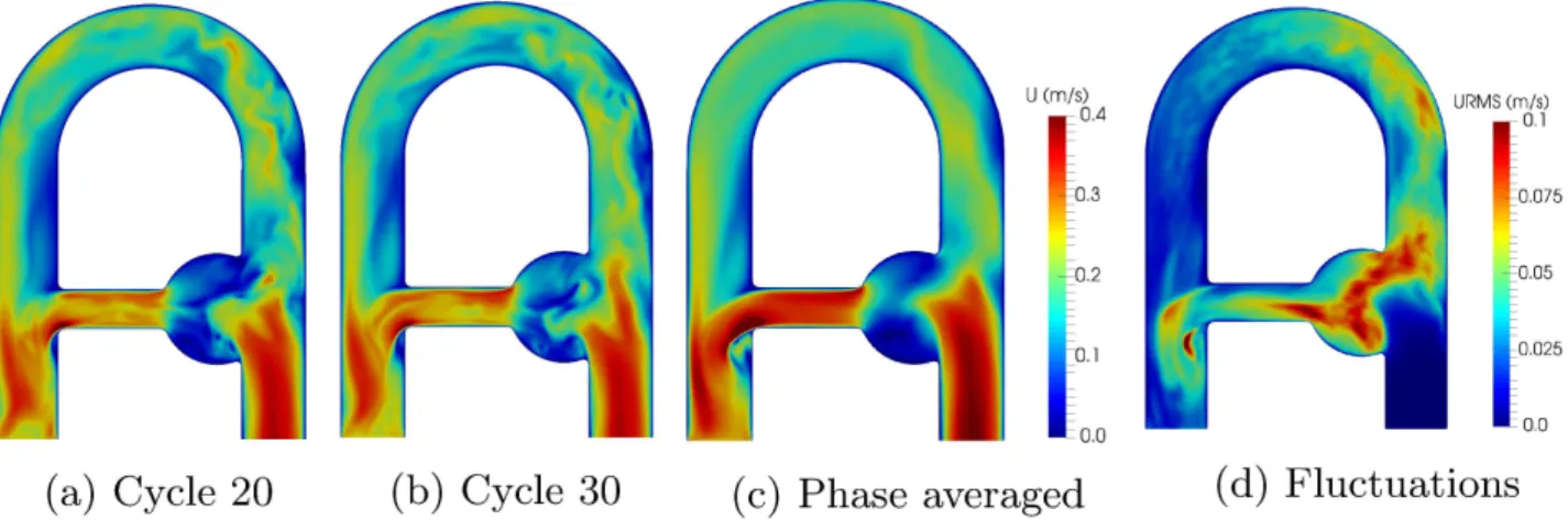 FIGURE 4 Magnitude velocity fields in the flow phantom at peak systole for cycle 20 (a), cycle 30 (b), phase-averaged (c).