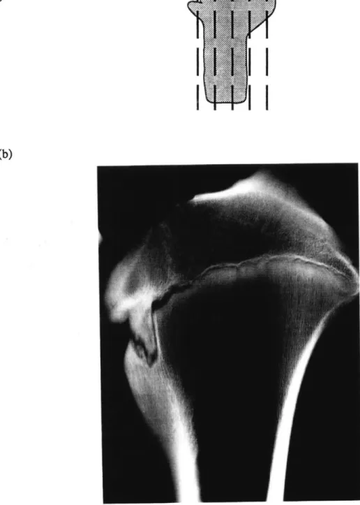 Figure 2.1:  (a) Head  of the proximal tibia cut sagittally  into slabs.