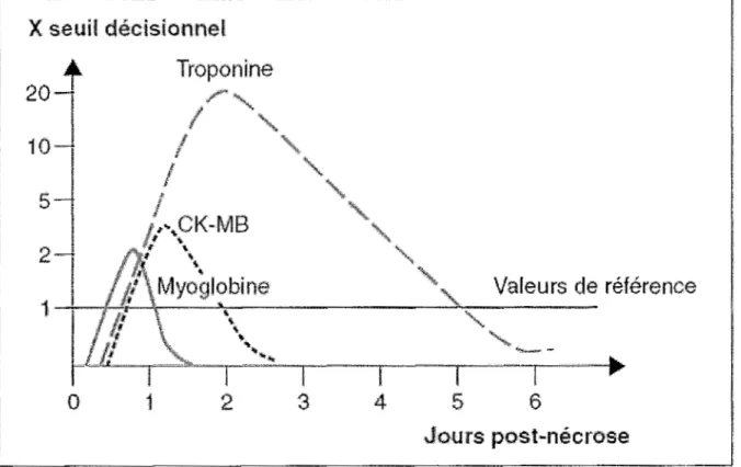 Figure 5: Profil de libération de la troponine (47) 