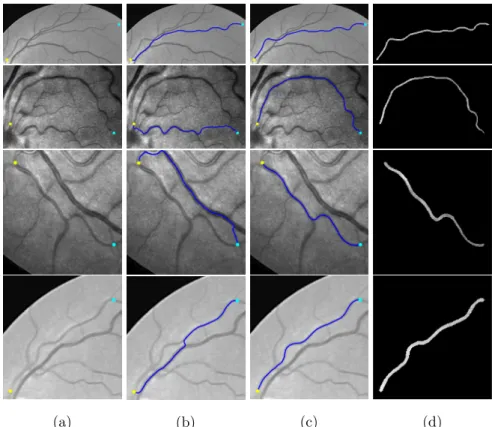 Figure 10: Qualitative comparison results between the ArR and caArR metrics on retinal image patches