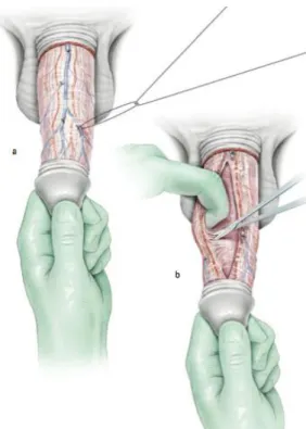 Figure 2. Dissection des bandelettes nerveuses 