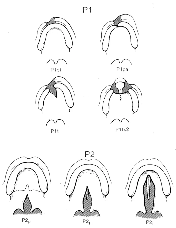 Figure 3 : Classification de STRICKER - VAN DER MEULEN