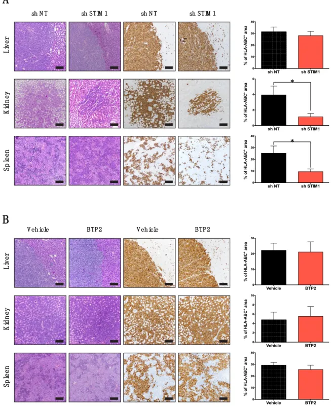 Figure  3.  STIM1,  but  not  Ca 2+ ,  regulate  DLBCL  dissemination  in  vivo.  (A)  Effect  of  STIM1  under- under-expression on HLY-1 cell dissemination