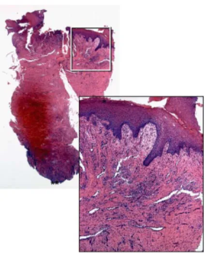 Fig. 1. A biopsy obtained after 3 weeks of healing. The tissue is rich in vessels, fibroblasts and inflammatory cells and is characterized as granulation tissue