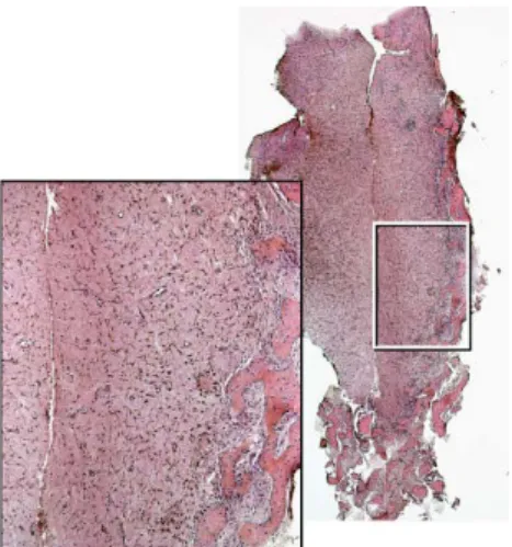 Fig. 4. Detail from Fig. 3 illustrating vascular structures that have been stained with CD 31.